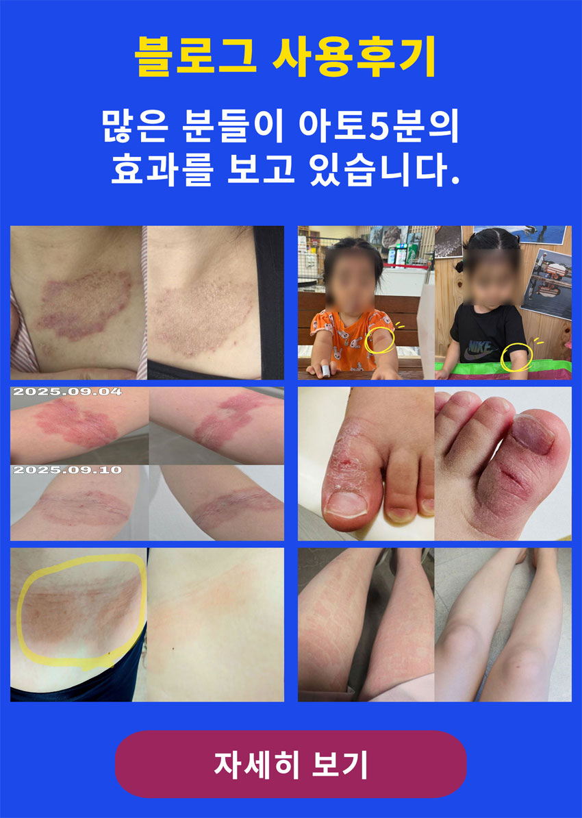 블로그 사용후기 보러가기