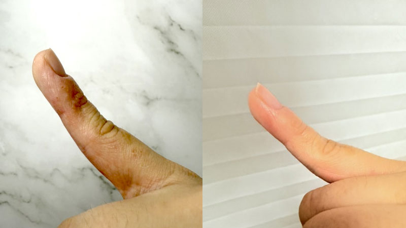 가려움이 사라지는 시간 | 놀란바이오-아토5분 수성 일주일 사용 후기